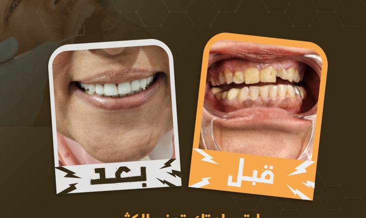 أفضل مركز لتجميل الابتسامة في الإمارات